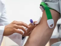 Preparation for blood test by female doctor medical uniform on the table in white bright room. Nurse pierces the patient's arm vein with needle blank tube.